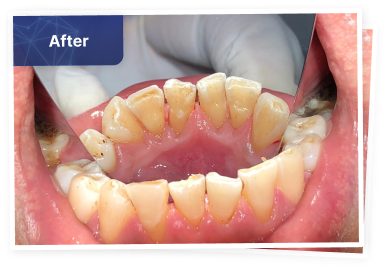 the dental co-after-01