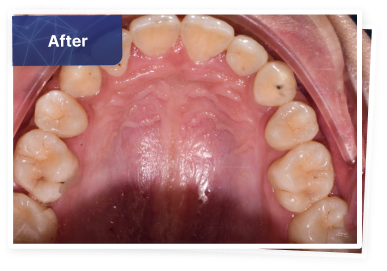the dental co-after-02