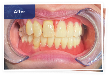 the dental co-after-04