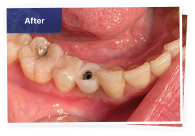 the dental co-after-05