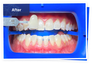 the dental co-after-06