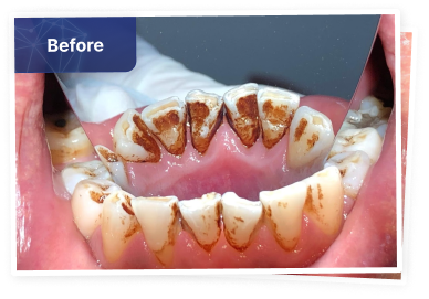 the dental co-before-01