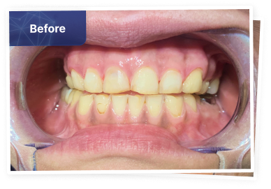 the dental co-before-03
