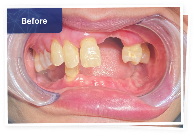 the dental co-before-04