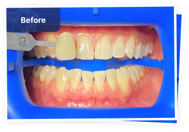 the dental co-before-06
